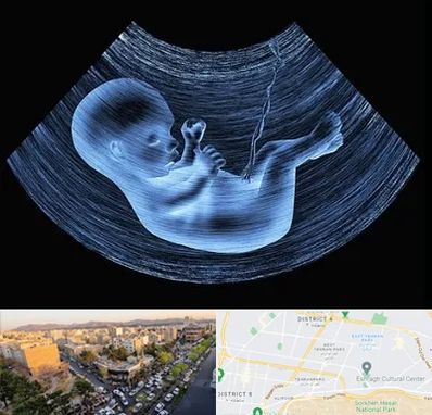 دکتر متخصص غربال گری در تهرانپارس 