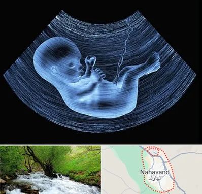 دکتر متخصص غربال گری در نهاوند