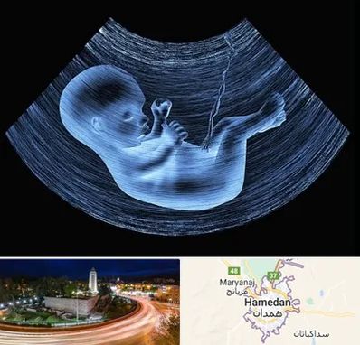 دکتر متخصص غربال گری در همدان