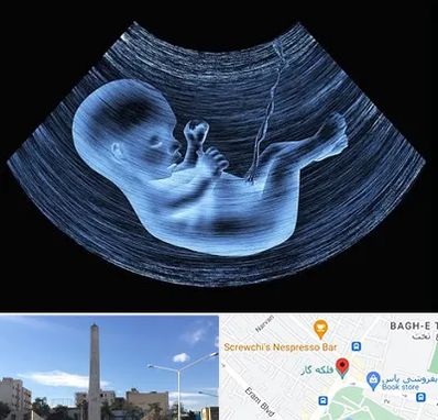 دکتر متخصص غربال گری در فلکه گاز شیراز