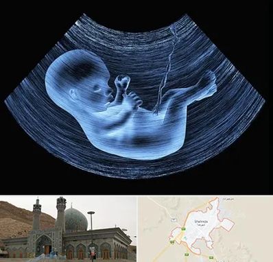 دکتر متخصص غربال گری در شهرضا