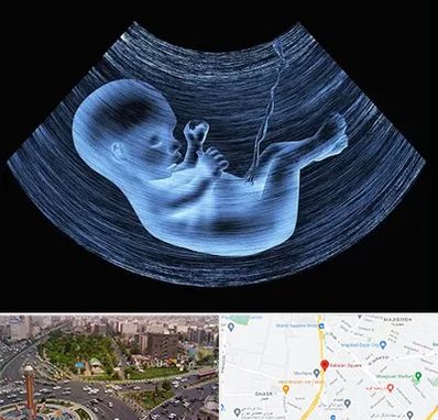 دکتر متخصص غربال گری در سبلان