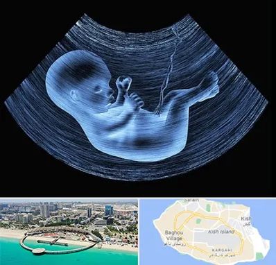 دکتر متخصص غربال گری در کیش