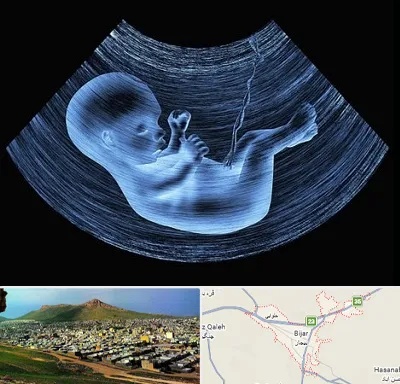 دکتر متخصص غربال گری در بیجار