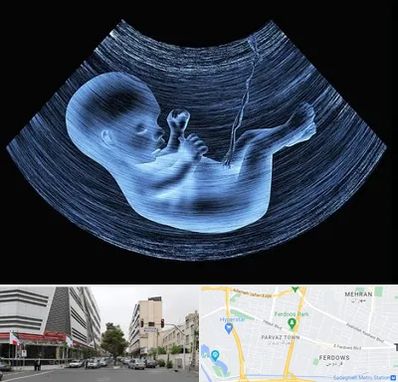 دکتر متخصص غربال گری در بلوار فردوس 