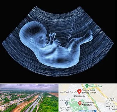 دکتر متخصص غربال گری در قصرالدشت شیراز