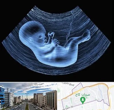 دکتر متخصص غربال گری در سعادت آباد 