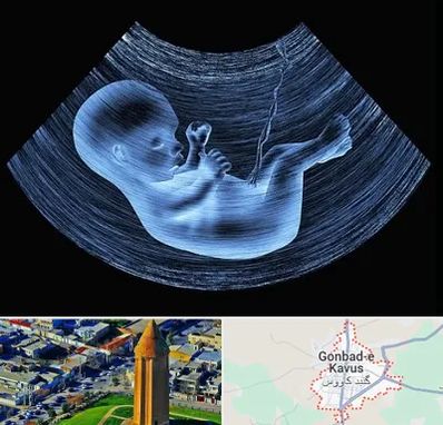 دکتر متخصص غربال گری در گنبد کاووس