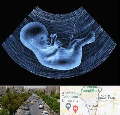 دکتر متخصص غربال گری در شهران 