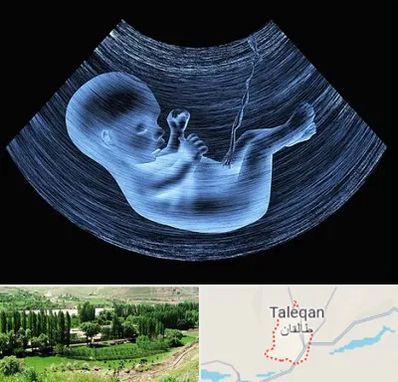 دکتر متخصص غربال گری در طالقان