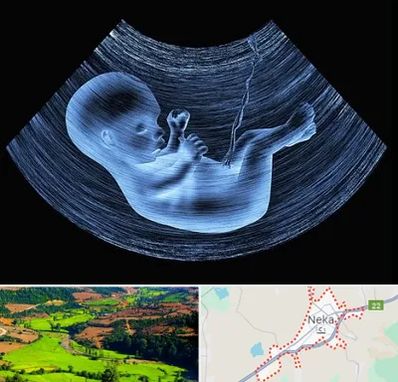 دکتر متخصص غربال گری در نکا
