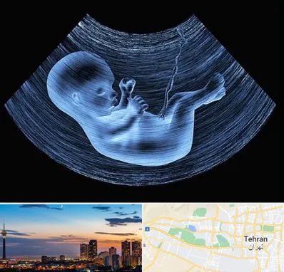 دکتر متخصص غربال گری در غرب تهران 