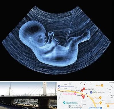 دکتر متخصص غربال گری در پارک وی 