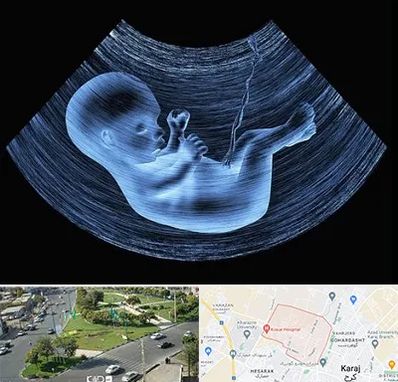 دکتر متخصص غربال گری در شاهین ویلا کرج