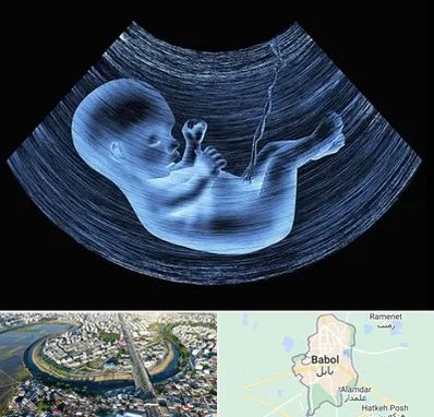 دکتر متخصص غربال گری در بابل