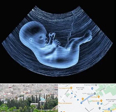 دکتر متخصص غربال گری در محلاتی شیراز