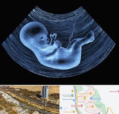 دکتر متخصص غربال گری در خیابان نیایش شیراز