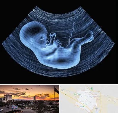 دکتر متخصص غربال گری در قوچان