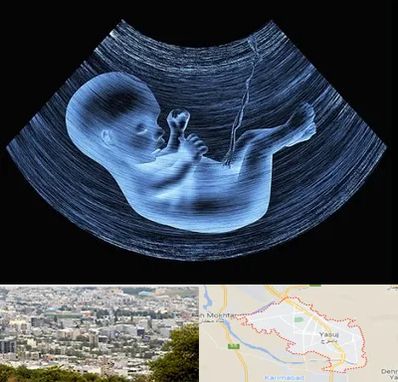 دکتر متخصص غربال گری در یاسوج