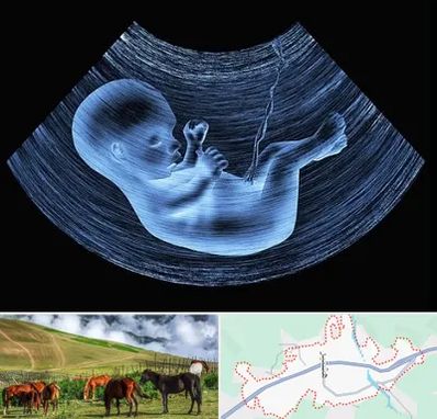 دکتر متخصص غربال گری در تالش