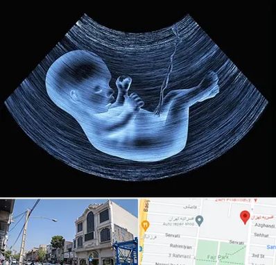 دکتر متخصص غربال گری در افسریه 