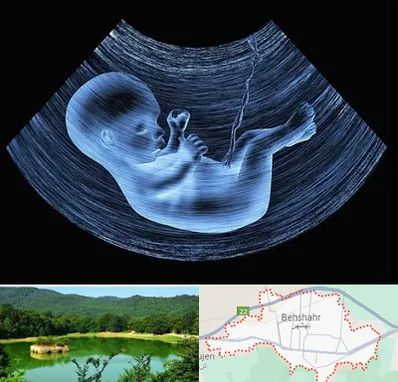 دکتر متخصص غربال گری در بهشهر
