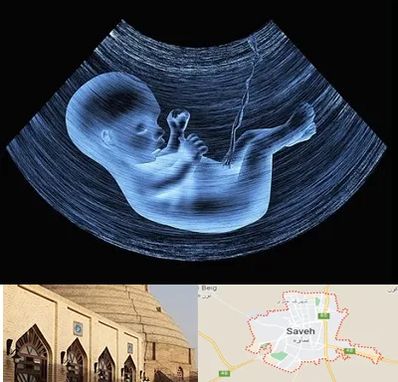 دکتر متخصص غربال گری در ساوه