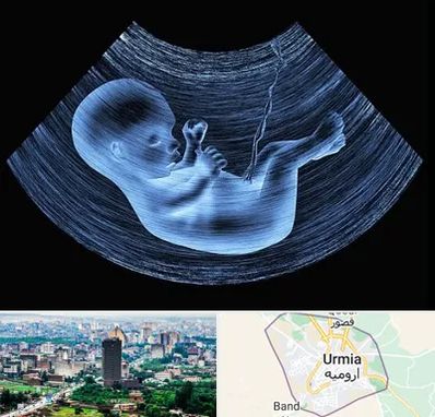 دکتر متخصص غربال گری در ارومیه