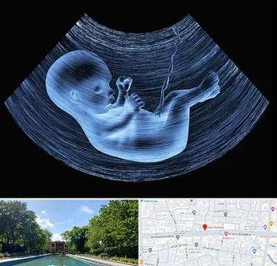 دکتر متخصص غربال گری در هشت بهشت اصفهان