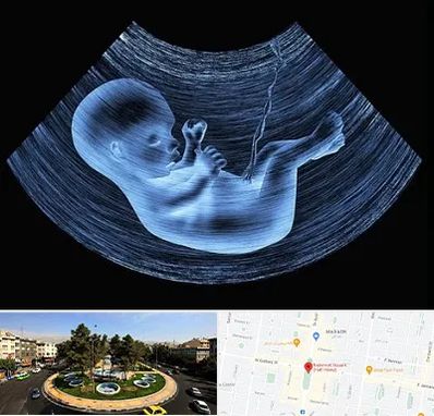 دکتر متخصص غربال گری در هفت حوض