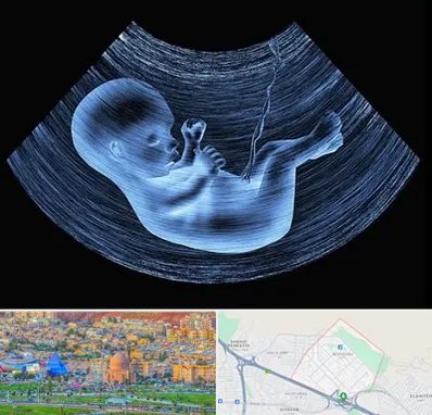 دکتر متخصص غربال گری در رشدیه تبریز