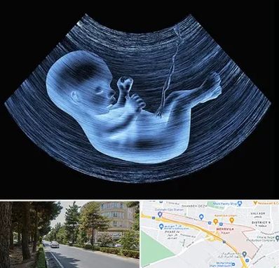 دکتر متخصص غربال گری در مهرویلا کرج