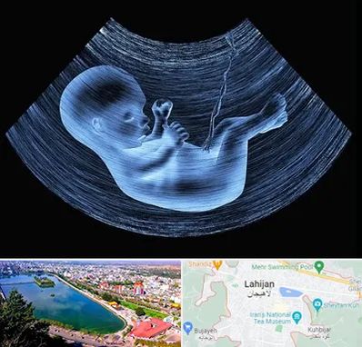 دکتر متخصص غربال گری در لاهیجان