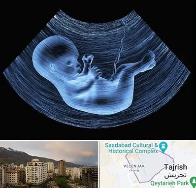 دکتر متخصص غربال گری در زعفرانیه 