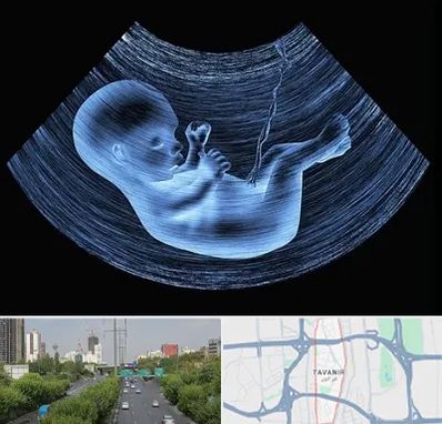 دکتر متخصص غربال گری در توانیر