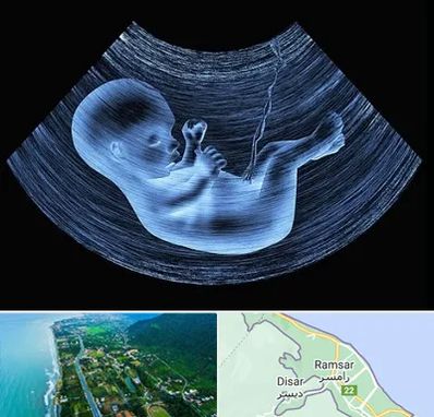 دکتر متخصص غربال گری در رامسر