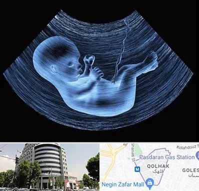 دکتر متخصص غربال گری در قلهک 