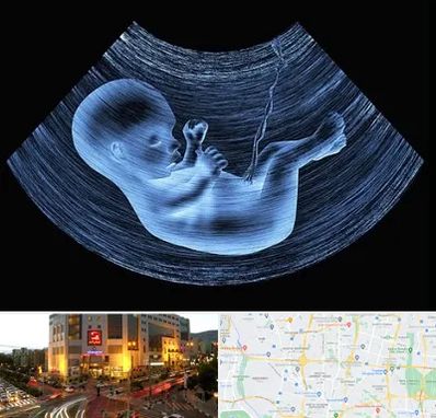 دکتر متخصص غربال گری در جنت آباد تهران 