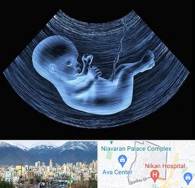 دکتر متخصص غربال گری در آجودانیه 