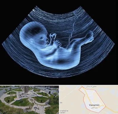 دکتر متخصص غربال گری در ورامین