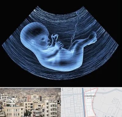 دکتر متخصص غربال گری در اسکندری