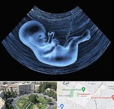 دکتر متخصص غربال گری در جهانشهر کرج 