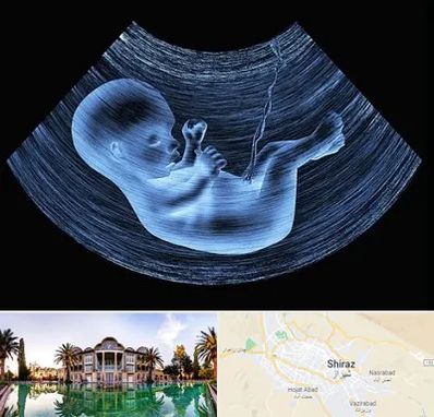 دکتر متخصص غربال گری در شیراز