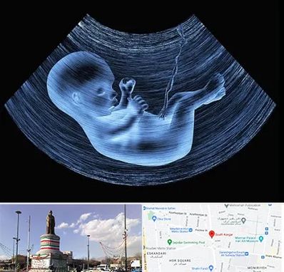 دکتر متخصص غربال گری در کارگر جنوبی