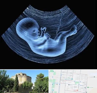 دکتر متخصص غربال گری در مرداویج اصفهان