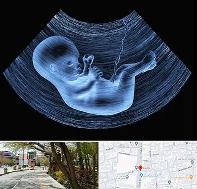 دکتر متخصص غربال گری در خیابان توحید اصفهان