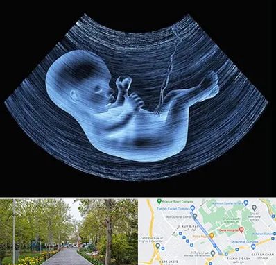 دکتر متخصص غربال گری در قدوسی غربی شیراز