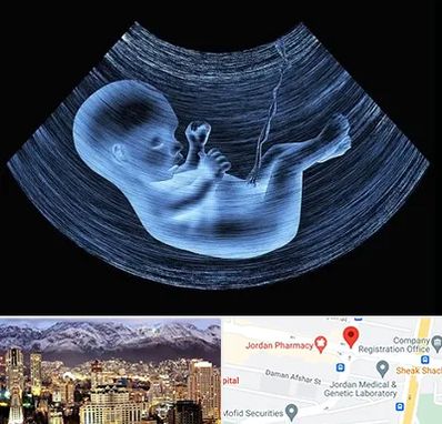 دکتر متخصص غربال گری در جردن 