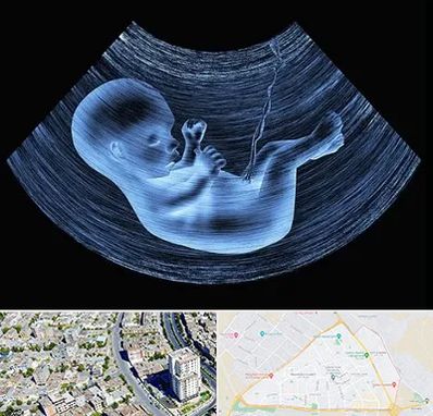 دکتر متخصص غربال گری در قاسم آباد مشهد