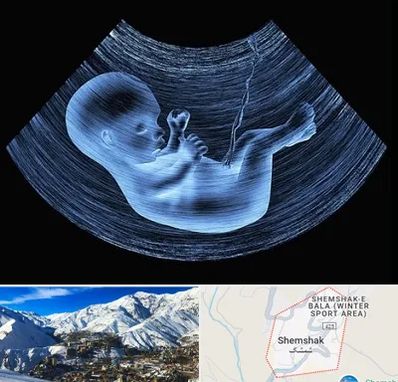 دکتر متخصص غربال گری در شمشک